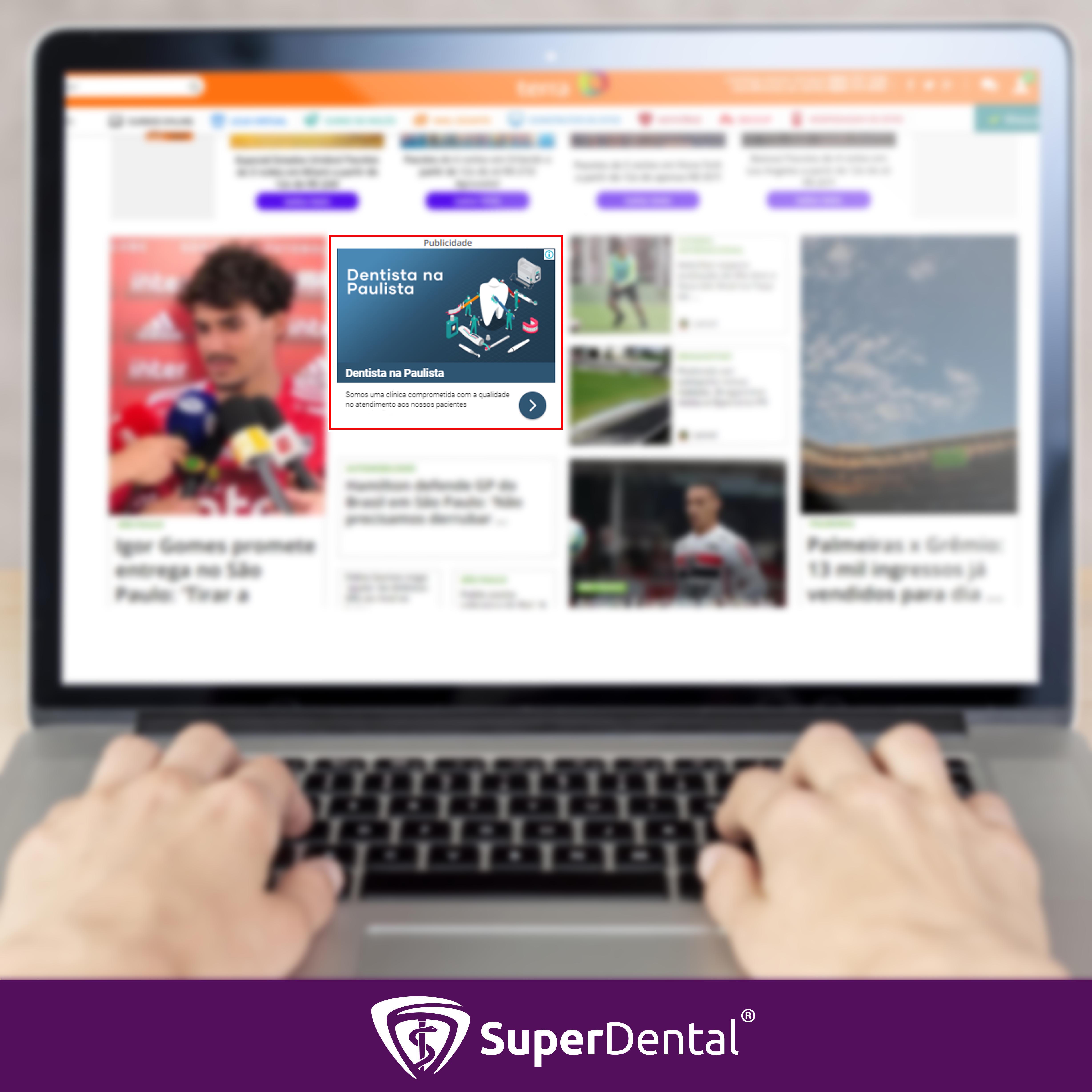rede de display superdental